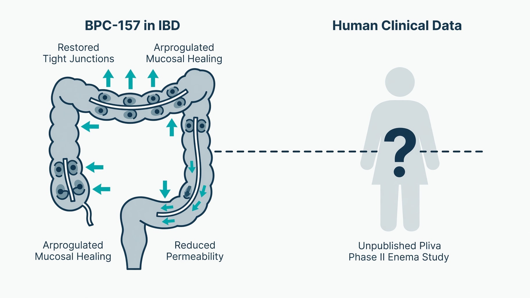 Scientific diagram and data graphic for BPC-157 in IBD: Preclinical Repair Mechanisms Versus Absent Human Efficacy Data